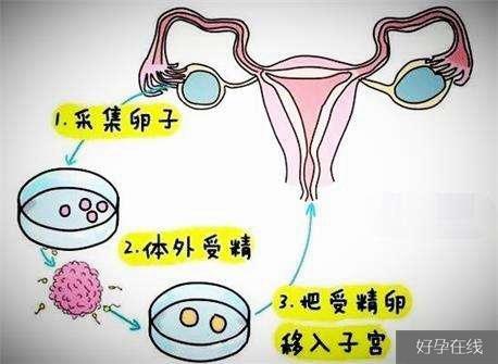 国内供卵试管代怀零风险_国内供卵试管代怀零风险:安心选择生育的最佳方案