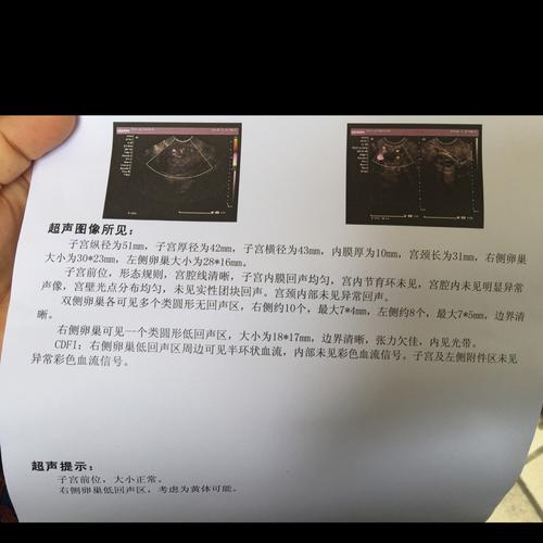 供卵试管代怀双胞胎电话_寻找供卵试管代怀双胞胎电话,解答你的疑惑