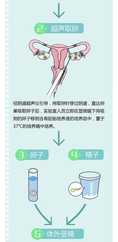 医院供卵试管代怀流程_医院供卵试管代怀流程解析